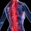 Arthritis